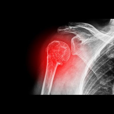 西宮市で野球肩に専門的な整体院。タブチ神経整体院